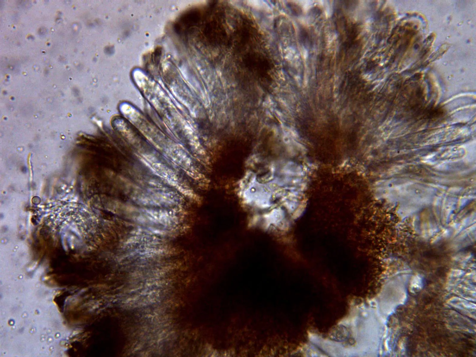 Microscopía de Tympanis pini - 11 - Ascos x 400
